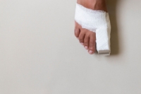What Does a Broken Toe Look Like?