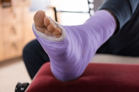 Foot Stress Fracture Symptoms