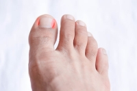 Older People May Be Prone to Getting Ingrown Toenails