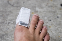 Treatment of Toe Fractures
