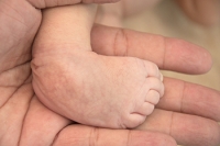 Clubfoot Develops During Pregnancy