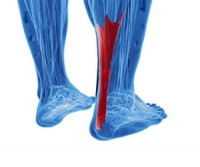 Types of Achilles Tendon Injuries