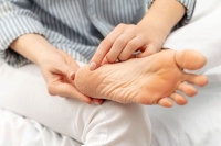 Podiatrists Can Manage Cracked Heels