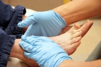 Diabetic Foot Problems