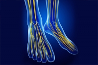 Multiple Sclerosis and Hot Feet